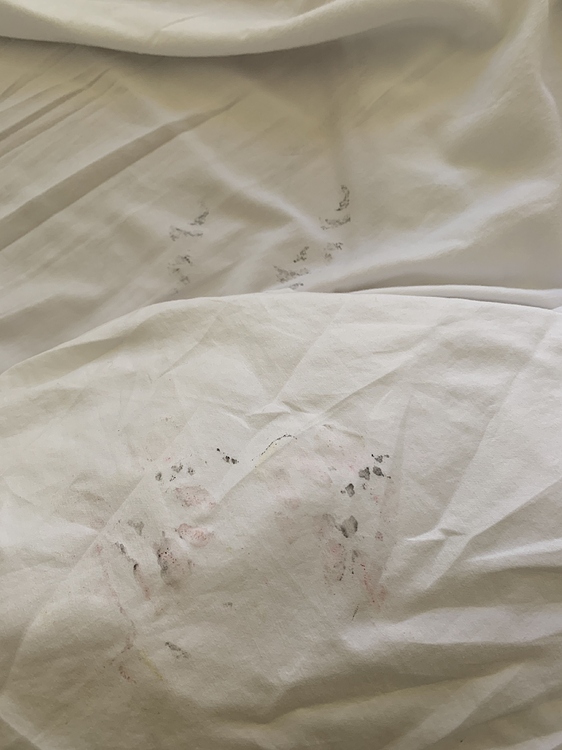 Removing tattoo ink from bed sheets? AirBnB hosts forum